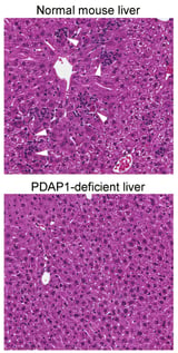 Scientists implicate a novel cellular protein in hepatitis A infection