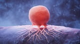 The Fibroblasts That Protect Ovarian Cancer