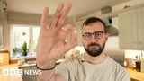 'My peanut allergy nearly killed me - now I eat them every day'
