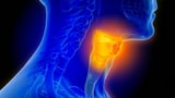 Perioperative Pembrolizumab Approved to Up Chance of HNSCC Cure