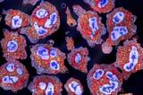 Restoring ability to remove zombie cells may keep us sharp as we age