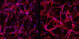 Lab-grown retinal cells show promise for new eye therapies
