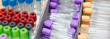 What Does Lantheus Holdings (LNTH) FDA Approval Mean For Its Alzheimer’s Push?