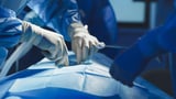 Scientists perform the first pig-to-human lung transplant