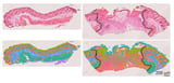 Some aging cells heal wounds, others cause harm: Study shows how to distinguish between the two