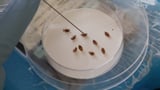 Bedbugs can cause people to lose sleep – and blood. Here’s what to do about them