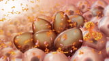 MRD Negativity Improves With Daratumumab Maintenance Combo in NDMM