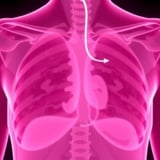 New Study Sheds Light on Predicting Chemotherapy Response in