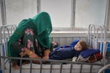 Malnutrition stalks the most vulnerable in Afghanistan as aid cuts leave millions helpless