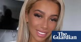 Woman who died after ‘butt lift’ surgery did not give informed consent, Bolton coroner rules