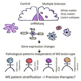 Multiple sclerosis brain atlas could pave way for personalized treatments