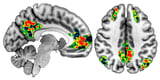 Neural activity linked to self-preoccupied thinking