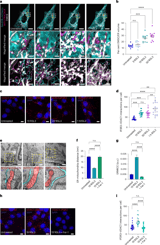 Endoplasmic reticulum–mitochondria contacts are prime hotspots of phospholipid peroxidation driving ferroptosis