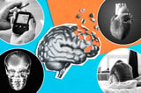 The common conditions that ‘significantly increase your risk of dementia’ – and the most dangerous ages to...