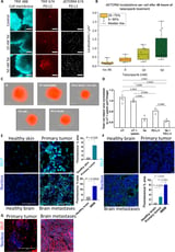 Biodegradable nanoparticles enable simultaneous delivery of two drugs to attack tumors