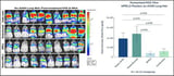 Genprex Collaborators Publish Positive Preclinical Data with NPRL2 Gene Therapy Utilizing Oncoprex® Delivery System