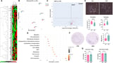 Aggressive breast cancer triggered by obesity-related blood signals, study shows