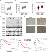 The activation of the Notch signaling pathway by UBE2C promotes the proliferation and metastasis of hepatocellular carcinoma