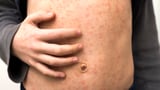 Measles in WA: Sixth case recorded in September, authorities urge families to check jab status before holidays
