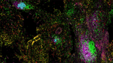 AI-powered atlas reveals new insights into tertiary lymphoid structures as prognostic and response biomarkers in cancer | Newswise