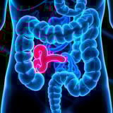 MAPK Fuels Colorectal Cancer Therapy Resistance