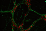 Gut neurons help body fight inflammation with immune-regulating molecule