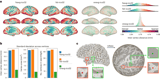 A cortical surface template for human neuroscience