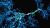 Penn and Miami launch study to detect ALS and FTD with $26M grant | Penn Medicine