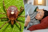 First case of untreatable, potentially fatal Bourbon virus confirmed in New York