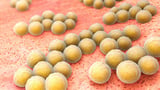 Staphylococcus aureus Infection Risk High in Very Low Birth Weight Hospitalized Infants