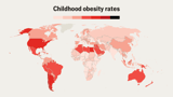 A world map of childhood obesity