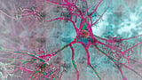 Scientists may have found aging’s hidden trigger for brain disease