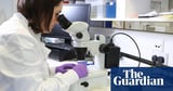 Number of early-stage cancer diagnoses in England at record level, NHS says