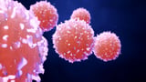Textured Breast Implants and BRCA Mutations Increase Lymphoma Risk in Women
