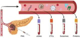 Evolution of Liquid Biopsies for Detecting Pancreatic Cancer