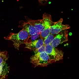 Breast cancer and autism: Visualization of the oxytocin receptor enables new theranostic approaches