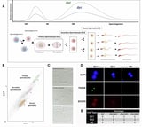 Missing Y gene linked to male infertility