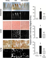 Digestive enzyme leakage from gut to organs may cause aging in rats