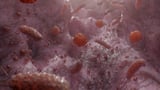'Truly miraculous': Common gut microbe shows promise as fatty liver disease treatment