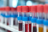 Blood Sample Allows for Rapid Detection of Brain Cancer - Neuroscience News