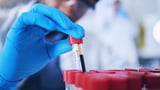 Simple Blood Test Shows How Well You’re Aging
