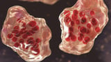 ‘Get vaccinated’: Warning to Aussie workers