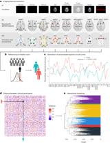 Personalized brain circuit scores identify clinically distinct biotypes in depression and anxiety