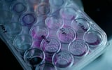 Widely used asthma drug may improve performance of cancer immunotherapies