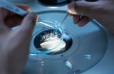 First Trimester Key in Human Brain Evolution