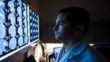 Brainy AI: UK taps into 1.6 million brain scans to defeat dementia