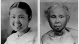 Common supplement reverses premature aging in landmark human trial