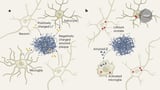 Does lithium deficiency contribute to Alzheimer’s disease?