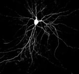 How a brain messenger protein drives progression of Alzheimer’s disease