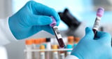 11k Brits could be misdiagnosed with silent killer after horror NHS test mix-up